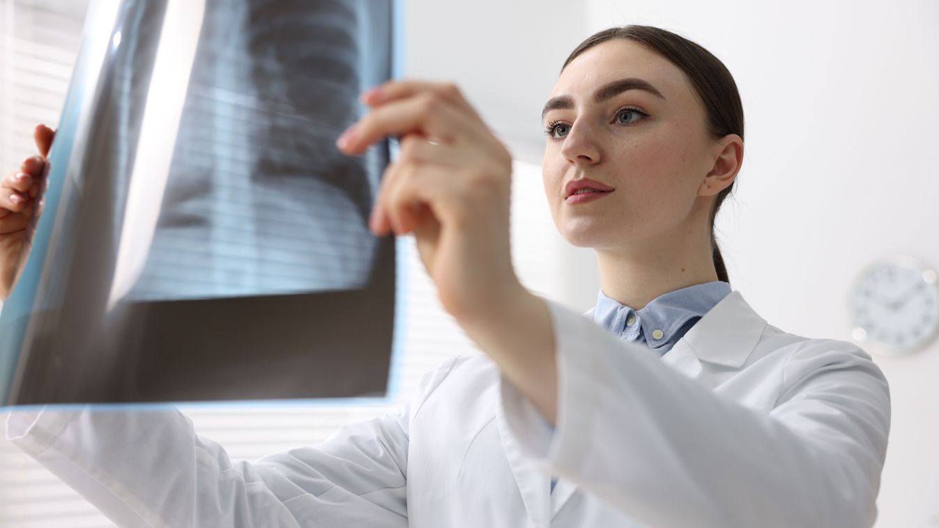 Súlyos járványveszély: Ukrajna a tuberkulózisfertőzés gócpontja